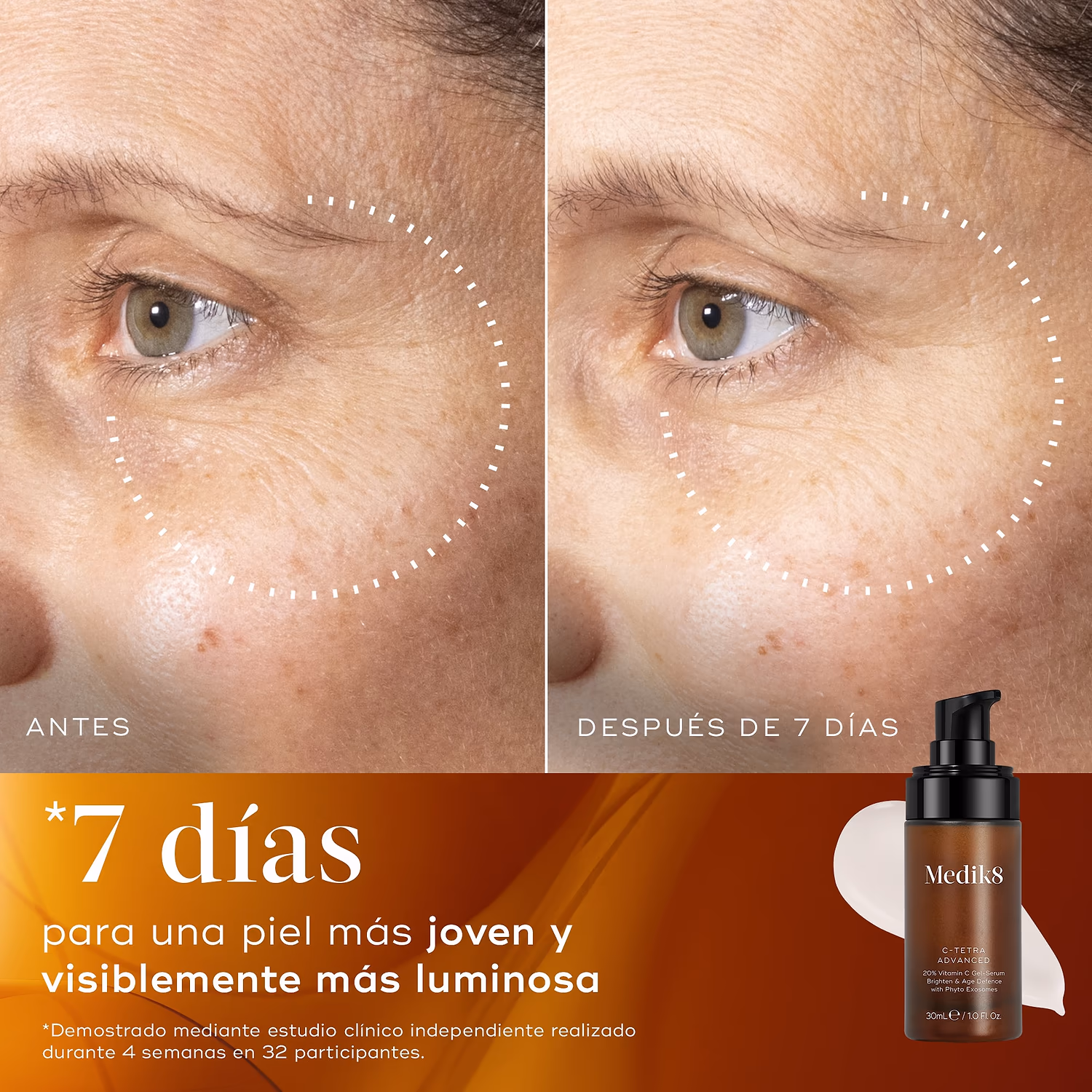 C TETRA ADVANCE SERUM